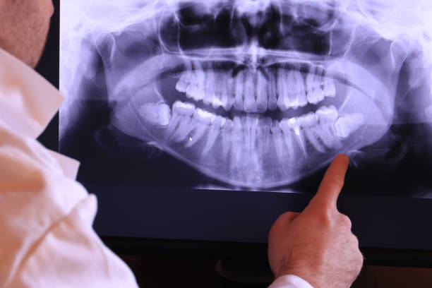 Best Emergency Dental Surgery in Hernando Beach, FL
