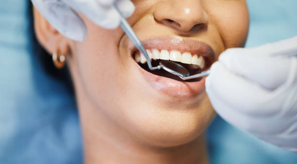 Best Emergency Broken Tooth Repair in Hernando Beach, FL